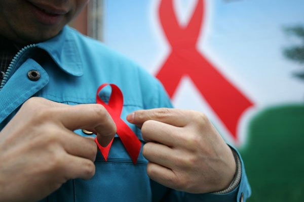 AIDS (3)